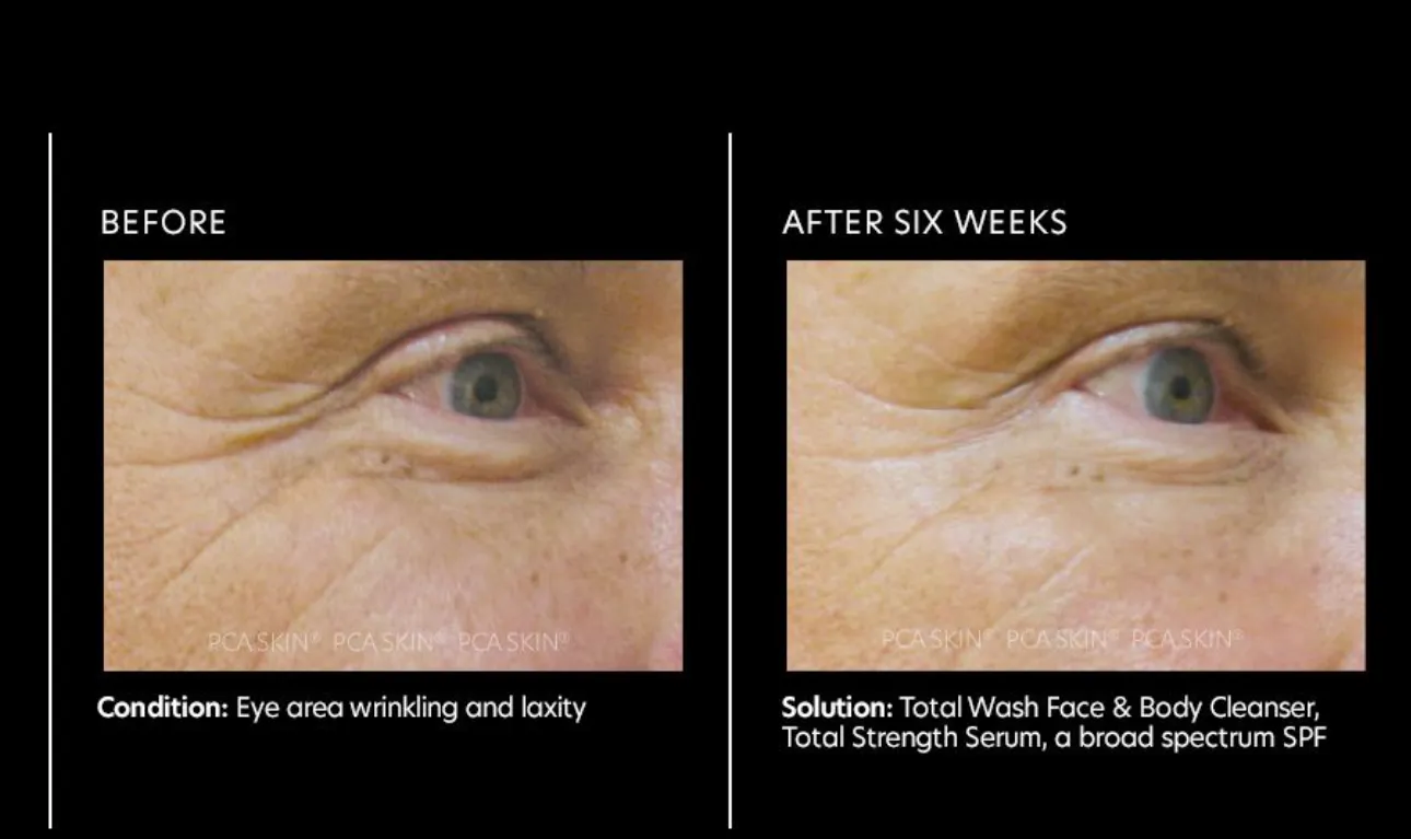 Total Strength Serum